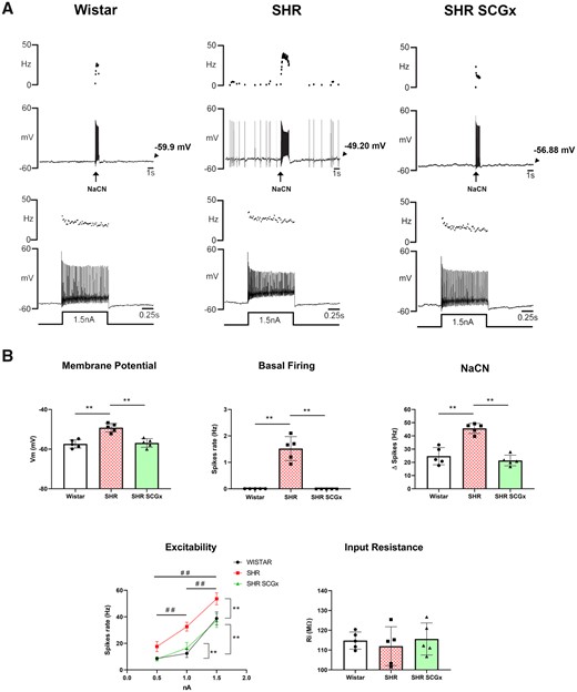Effect of unilateral SCGx on ipsilateral chemoreceptive PG neurones. (A) Representative whole-cell current clamp recordings from chemoreceptive petrosal neurones from a Wistar (top left, n = 5), SH rat (SHR; top middle, n = 5), and SCGx SHR (top right, n = 5) recorded from the in situ WHBP. Ongoing and evoked firing responses to chemoreflex stimulation or injected depolarizing current were all reduced after SCGx in SHR. (B) Changes in resting membrane potential (Vm), spontaneous basal firing, reflex responsiveness to NaCN injections (50 µL of 0.3 µg/µL), input resistance, and firing rate to injected depolarizing currents (0.5, 1, and 1.5 nA) are shown. Data were analysed using one-way ANOVA with Dunnett’s post hoc test or Kruskal–Wallis with Dunn’s post hoc test. Neuronal excitability was analysed using GEE and Bonferroni as post hoc test; *P < 0.05; **P < 0.01; ##P < 0.01 vs. injected current.