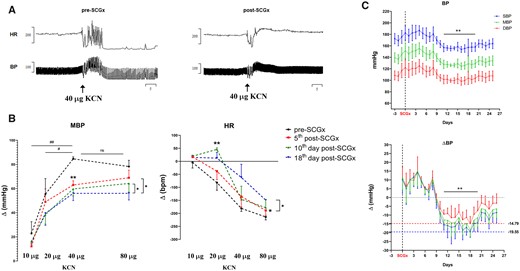 Effects of bilateral resection of the SCGx on chemoreflex and resting BP in in vivo conscious SH rats. The chemoreflex was evoked by intravenous injections of KCN (2 µg/µL; n = 5). The depicted responses for each dose of KCN represent the average from 2 consecutive days from both pre-SCGx and post-SCGx (i.e. 5th and 6th day after ganglionectomy). (A) Representative tracing from the CB-evoked cardiovascular response (KCN = 40 µg) before and after bilateral SCGx. (B) CB-evoked changes in MBP, mean blood pressure; HR, heart rate. (C) Long-term effect of bilateral SCGx on BP of SH rats (n = 4). BPs have averaged epochs of 5 h recordings performed between 17 and 22 h. Data analysed using GEE and Bonferroni as post hoc test; *P < 0.05; **P < 0.01; ##P < 0.01. Mixed-effects model was used to detect changes in BP over time; Dunnett’s post hoc test was used to compare post-SCGx days vs. Day 0, i.e. SCGx, **P < 0.01.