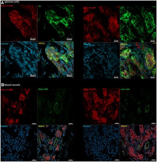 Photomicrographs of CB immunopositivity for TH and α1-adrenoceptor subtypes in Wistar rats (n = 3). (A) α1A-and α1B-adrenoreceptors (Alpha 1A/B-ADR; red, Alexa Fluor 594) with TH (green, Alexa Fluor 488), a marker for glomus cells. (B) α1A- and α1B-adrenoreceptors (Alpha 1A/B-ADR; red, Alexa Fluor 594) co-localized with α-SMA (green, Alexa Fluor plus 488), a marker for blood vessels. Hoechst staining is shown for cellular nuclei (blue). Images acquired using Zeiss LSM 800 Airyscan.