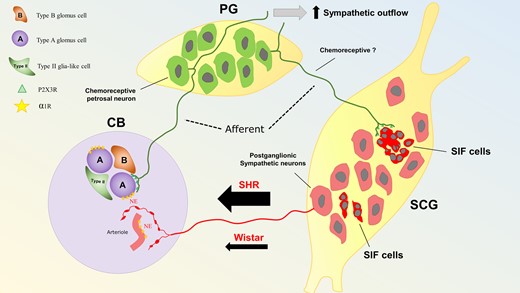 Proposed mechanism of hyperexcitability of the CB in SHR. The CB receives afferent (green) and efferent (red) innervation from the PG and SCG, respectively. Within the CB, connections are made with two main structures: Type A glomus cells and vasculature (arterioles, capillaries, and venules). Type A glomus cells receive inputs from purinergic PG afferent neurones positive for P2X3 receptors (P2X3R).13 In contrast, the vasculature is innervated by postganglionic sympathetic neurones (red) from the SCG. Both the CB vasculature and glomus cells express α1-adrenoreceptors (α1R; Figure 6) and although glomus cells are not directly innervated by postganglionic sympathetic neurones, sympathetic varicosities were shown to be located close enough to glomus cells clusters to allow noradrenaline (NE) to diffuse and reach their receptors. In SHR, a more active sympathetic input to the CB exists compared with Wistar rats (Figures 3–5). In the SCG, a subpopulation of SIF (intense red) cells, organized in clusters, receive innervation from afferent purinergic PG neurones; these cells have been proposed to be ectopic glomus cells and could contribute to the CB-evoked sympatho-hyperreflexia and increased peripheral sympathetic outflow. Data from.25,34,38,39
