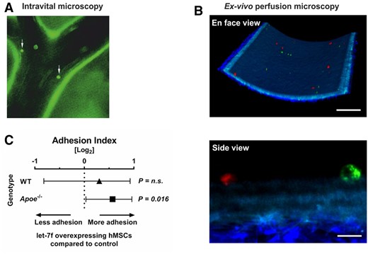 hMSC adhere to murine carotid arteries. (A) hMSCs labelled with a cell tracker were adoptively transferred into Apoe−/− mice fed with high-fat diet for 4 weeks and interactions with the arterial endothelium of the carotid artery was visualized by epifluorescence microscopy (white arrows). (B) Carotid arteries were explanted from Apoe–/– mice fed with high-fat diet. A 1:1 mixture of red and green labelled hMSCs transfected with let-7f mimics or non-specific oligonucleotide control were perfused through the mounted vessel. Adherent hMSCs were detected in randomly selected areas and analysed using two-photon laser scanning microscopy. Scale bars: 100 µm (en face view) and 10 µm (side view). (C) Quantification of the ex vivo adhesion assay. The Forest plot shows the adhesion index of let-7f-transfected hMSCs (ratio of adherent let-7f-transfected to control siRNA-transfected hMSCs) perfused in mounted carotid arteries of Apoe−/− (n = 5) and wildtype mice (WT) (n = 2). Results were collected in 8 different fields of view per mouse (n = 40 in Apoe–/– and n = 16 in WT mice). P-values computed by Wilcoxon signed-rank test (C). n.s., not significant.