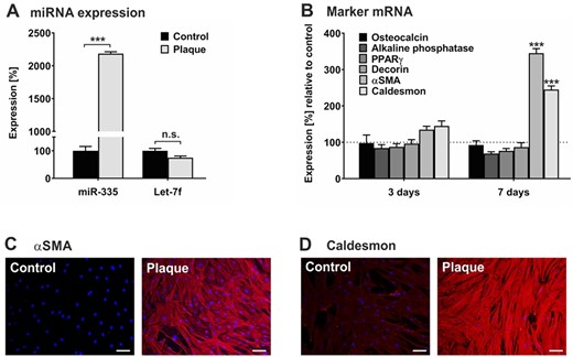 Human plaque promotes myogenic differentiation in hMSCs. hMSCs were cultivated in serum-free medium (control) or in the presence of a 1:100 dilution of pooled protein extracts obtained from human atherosclerotic plaques of 5 patients (plaque). (A) After 24 h, RNA was collected and subjected to quantification of miR-335 and let-7f expression levels using qRT-PCR. The values shown were normalized to snoRNA and given in percent to control set as 100%. (B) After 3 days and 7 days, cells were analysed for mRNA expression of gene transcripts as indicated using qRT-PCR. The values were normalized to GAPDH and are given in percent to control set as 100%. (C, D) After 7 days, cells were analysed by immunocytochemistry for the expression of αSMA (C) and caldesmon (D) stained with anti-rabbit IgG (Star 635P, red). DAPI (blue) was used for nuclear staining. Magnification ×4. Scale bars, 5 µm. Data shown in A and B are given as mean values ± SD of triplicate measurements (n = 3). Protein data are representative of 3 independent measurements (n = 3). n.s., not significant; **P < 0.01, ***P < 0.001 as computed by two-way ANOVA with Bonferroni post hoc test (A, B).