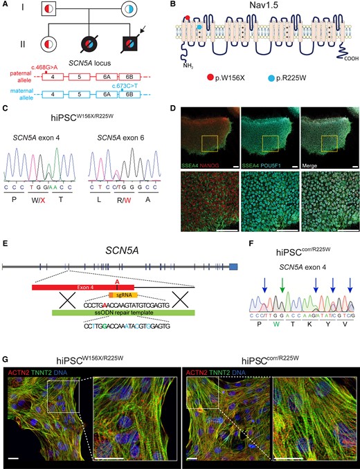 Generation of hiPSCs from a patient with compound heterozygous mutations in SCN5A and their genetic correction. (A) Top, family tree of the proband (arrow) showing in black filling the patients affected by cardiac conduction defects and in white unaffected individuals. Red (left) and light blue (right) colours within the family tree symbols indicate the genotype at the SCN5A locus, as indicated at the bottom of the figure. Red (top), paternal allele carrying the c.468G>A SCN5A (p.W156X) mutation in exon 4; light blue (bottom), maternal allele carrying the c.673C>T SCN5A (p.R225W) mutation in exon 6B. (B) Schematic representation of the sodium channel Nav1.5 α-subunit, encoded by SCN5A. The red (left) and the light blue (right) circles show the position of p.W156X and p.R225W mutations, respectively. (C) Sanger sequencing chromatograms showing the c.468G>A SCN5A (p.W156X) mutation in exon 4 (left), and the c.673C>T SCN5A (p.R225W) mutation in exon 6B (right), both present in heterozygosis in the patient-derived hiPSCW156X/R225W line. (D) Representative immunofluorescence images of hiPSCW156X/R225W undifferentiated colonies showing expression of pluripotency markers NANOG (red), SSEA4 (green), and POU5F1 (cyan). Bottom panels are an enlargement of the framed area in top panels. Scale bars: 25 µm. (E) Schematic showing the strategy used to correct the c.468G>A (p.W156X) mutation in SCN5A exon 4 with CRISPR/Cas9 in the paternal allele of hiPSCW156X/R225W. The mutant adenine base is shown in red; in yellow the sgRNA guiding the Cas9 to the mutation; in green the ssODN used as donor template for homology-directed DNA repair. Underneath part of the ssODN sequence, showing in green the WT guanine base and in light blue the silent mutations. (F) Sanger sequencing chromatogram showing SCN5A exon 4 after correction of the c.468G>A (W156X) mutation in hiPSCcorr/R225W. The green arrow (second arrow from the left) indicates the corrected patient mutation and the blue arrows indicate the silent mutations inserted in one allele. (G) Representative immunofluorescence staining for ACTN2 (red) and TNNI3 (green) in hiPSCW156X/R225W- and hiPSCcorr/R225W-CMs. Nuclei are stained with Dapi (blue). Panels on the right are enlargement of the framed area in the left panels. Scale bars: 10 µm.