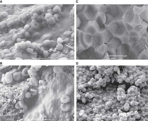 Fibrin biofilm covering intracoronary thrombi retrieved from acute myocardial infarction patients during thrombectomy (panel A and B) and polyhedrocytes formed in vivo within intracoronary thrombus (panel C) or ex vivo within whole blood clot (panel D). Images from ref.143 (panel A and B) are reproduced with permission from the Editorial Office of Cardiovascular Research.