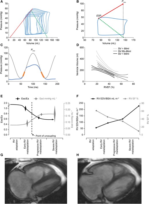 Multiple (A) and single beat (B) pressure–volume loops to calculate RV-arterial coupling, RV pressure curve with Pmax calculation (C) and EDV to EF relationships (D), evolution of respectively Ees/Ea, Eed (E) and EF and EDV (F) in patients with progressively severe PH, and MRI of end-systolic (G) and EDVs (H) to calculate EF. After reference21 with permission. BSA, body surface area.