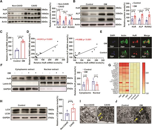 HuR is upregulated in human calcific aortic valves and associated with osteogenic differentiation of VICs. (A) HuR protein expression in valves of patients with calcific CAVD and non-CAVD controls (n = 10). (B) Protein expression of HuR, ALP, and RUNX2 in hVICs after osteogenic induction using OM (n = 6). (C) HuR mRNA expression in hVICs after osteogenic induction (n = 6). (D) Pearson’s correlation analysis between mRNA levels of HuR and osteogenic differentiation markers ALP and RUNX2 in VICs after osteogenic induction (n = 12). (E) Fluorescence-labelled HuR protein shuttling from the nucleus to the cytosol in hVICs after osteogenic induction. Nuclei are stained using DAPI (), scale bar = 25 μm. (F) HuR protein expression in cytosolic and nuclear fractions from hVICs after osteogenic induction by OM (n = 6). (G) Heatmap showing upregulation of positive regulators of autophagy upon OM stimulation. (H) Autophagy marker LC3 protein expression in hVICs after osteogenic induction compared with expression levels in controls (n = 6). (I, J) TEM analysis was performed on human calcified and non-calcified aortic valves as well as hVICs stimulated with OM to identify autophagic vesicles (arrows). Scale bar = 1 μm. Actin (A–B) or GAPDH (F, H) protein levels were used for normalization. Values are mean ± SD. Statistical differences were determined using two-tailed unpaired Student’s t-test for two groups (A–C, F, and H). The association between two variables was evaluated using two-tailed Pearson correlation analysis (D). Statistical significance was set at P < 0.05.