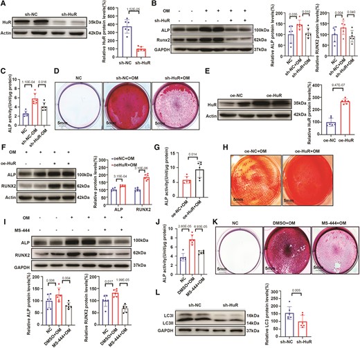 HuR knockdown inhibits osteogenic differentiation of hVICs in vitro. (A) Silencing efficiency of HuR with shRNA in human valvular interstitial cells (hVICs). (B–D) hVICs were transfected with sh-HuR or sh-NC and stimulated with osteogenic differentiation medium (OM) (n = 6). (B) Protein expression of the osteogenic differentiation markers ALP and RUNX2 was evaluated by western blot (n = 6). (C) ALP activity was evaluated by spectrophotometry (n = 6). (D) Mineralized bone matrix formation was evaluated by alizarin red staining, scale bar = 5 mm. (E) Overexpression efficiency of HuR with lentivirus transfection in VICs (n = 6). (F, G) Expression of osteogenic differentiation markers (F) and ALP activity (G) in hVICs transfected with NC or HuR overexpression lentivirus and stimulated with OM (n = 6). (H) Mineralized bone matrix formation was evaluated by alizarin red staining, scale bar = 5 mm. (I–K) Expression of osteogenic differentiation markers (n = 6) (I), ALP activity (n = 6) (J), and alizarin red staining (K) in hVICs treated with the HuR small molecule inhibitor MS-444 and stimulated with OM, scale bar = 5 mm. (L) Protein expression of the autophagy marker LC3 in hVICs transfected with sh-HuR or sh-NC (n = 6). Actin (A, E–F) or GAPDH (B, I, and L) protein levels were used for normalization. Values are mean ± SD. Statistical differences were determined using two-tailed unpaired Student’s t-test for two groups (A–C, E–G, I, J, and L). Statistical significance was set at P < 0.05.