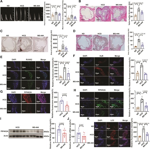 Targeted inhibition of HuR ameliorates aortic valve calcification in LDLR−/− mice by reducing autophagy. (A) Echocardiographic parameters, transvalvular peak jet velocity, and mean transvalvular pressure gradient, in the ND, HCD, and MS-444 groups (n = 10/group). (B) Representative haematoxylin and eosin (H&E) staining images and quantification of leaflet thickness in HCD and MS-444 groups (n = 10/group), scale bar = 200 μm. (C, D) Representative alizarin red (C) and von Kossa staining (D) images and quantification of calcium deposits in valve leaflets (n = 10/group), scale bar = 200 μm. (E) Fluorescence-labelled RUNX2 protein in valve leaflets of mice in the ND, HCD, and MS-444 groups was visualized by fluorescence microscopy (n = 6/group), scale bar = 50 μm. (F) Fluorescence-labelled HuR protein in valve leaflets of mice in the ND, HCD, and MS-444 groups (n = 6/group), scale bar = 50 μm. (G) RNA-FISH assay identifying Cy3-labelled PIP4K2A mRNAin valve leaflets of mice in the HCD and MS-444 groups (n = 6/group), scale bar = 50 μm. (H) Fluorescence-labelled PIP4K2A protein in valve leaflets of mice in the ND, HCD, and MS-444 groups (n = 6/group), scale bar = 50 μm. (I) PIP4K2A protein expression in heart tissues of mice in the HCD and MS-444 groups (n = 10/group). (J) Circulating PIP4K2A mRNA expression in HCD and MS-444 groups (n = 10/group). (K) Fluorescence-labelled LC3 protein in valve leaflets of mice in the ND and HCD groups (n = 6/group), scale bar = 50 μm. Nuclei are stained using DAPI. Actin (I) protein levels were used for normalization. Values are mean ± SD. Statistical differences were determined using two-tailed unpaired Student’s t-test for two groups (A–K). Statistical significance was set at P < 0.05.