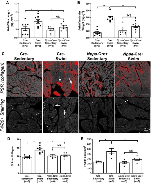 Atrial-specific Tnf gene ablation reduces exercise-induced increases in atrial hypertrophy, fibrosis, and inflammatory cell infiltration. (A and B) Atrial weights-to-tibial length and atrial weights-to-ventricular weights were increased in swim-trained vs. sedentary control (Cre−) mice (n = 8 per group). The degree of atrial hypertrophy with exercise was reduced in Nppa-Cre+ mice (n = 8 per group). (C) Top panel: Typical confocal micrographs of atrial sections stained with Picrosirius red (PSR). Collagen deposition (arrows) was reduced in swim-trained Nppa-Cre+ mice compared to swim-trained Cre− mice. Bottom panel: Confocal micrographs of atrial sections stained with F4/80+ to quantify macrophage infiltration (arrows). Macrophage counts were reduced in Nppa-Cre+ compared to Cre− swim-trained mice. (D) Quantification of collagen deposition (%) shows elevations in atrial fibrosis in Nppa-Cre+ swim (n = 7) compared to Cre− sedentary mice (n = 6). However, Tnf ablation in atrial myocardium reduces exercise-induced elevations in atrial fibrosis, with no differences observed between Nppa-Cre+ swim (n = 8) and Cre− sedentary (n = 6) mice. (E) Nppa-Cre+ swim-trained mice (n = 5) showed reduced exercise-induced macrophage infiltration (F4/80+ cell count) compared to Cre− swim mice (n = 5). Data presented as mean ± S.e.m. P values from two-way ANOVA with Sidak’s multiple comparison tests. *P < 0.05; **P < 0.01; ***P < 0.001 as indicated. NS, not significant. Scale bar = 50 μm.