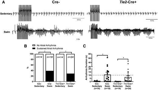 Endothelial-specific Tnf ablation does not protect against atrial arrhythmia inducibility in swim-trained mice. Atrial arrhythmia inducibility was determined using intracardiac octopolar catheters inserted into the right atria via the superior jugular vein. (A) Representative electrical recordings during and following programmed electrical stimulations in sedentary (n = 14 per group) and swim-exercised (n = 18 and 24, respectively, per group) mice with (Tie2-Cre+) and without (Cre−) endothelial cell-specific Tnf ablation. Prolonged highly disorganized electrical patterns lasting greater than 10 s, indicative of atrial arrhythmias, were seen in swim-exercised Tie2-Cre+ and Cre− mice. (B and C) Endothelial cell-specific Tnf ablation did not decrease (P value from 2 × 2 contingency table using Fisher’s exact test) the incidence atrial arrhythmias lasting >10 s or decrease the duration of arrhythmia episodes. Data presented as mean ± S.e.m. n values listed within each individual panel. P values for arrhythmia durations from Mann–Whitney U test with Dunn’s multiple comparisons test. *P < 0.05; **P < 0.01.