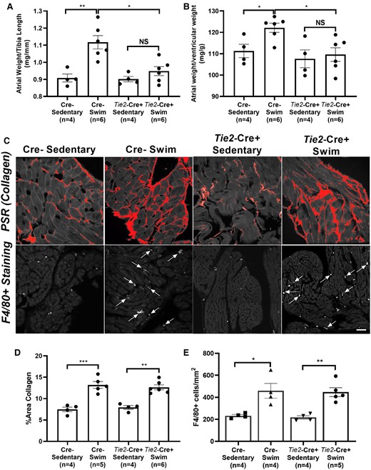 Endothelial cell-specific Tnf gene ablation reduces exercise-induced increases in atrial hypertrophy. (A and B) Atrial weights-to-tibial length and -ventricular weights were increased in swim-trained vs. sedentary mice without endothelial cell-specific Tnf excision (Cre−). Endothelial-specific Tnf ablation attenuated exercise-induced atrial hypertrophy. (C) Top panel: Typical confocal micrographs of atrial sections stained with Picrosirius red (PSR). Collagen deposition was increased in swim-trained Tie2-Cre+ and Cre− mice compared to their sedentary controls. Bottom panel: Confocal micrographs of atrial sections stained with F4/80+ to quantify macrophage infiltration (arrows). Macrophage counts were increased in Tie2-Cre+ and Cre− swim-trained mice compared to their sedentary controls. (D) Quantification of collagen deposition (%) shows elevations in atrial fibrosis in Cre− (n = 5) and Tie2-Cre+ (n = 6) swim mice compared to their sedentary controls (n = 4 and 4, respectively). (E) Both Cre− (n = 4) and Tie2-Cre+ (n = 5) swim-trained mice showed increased macrophage infiltration (F4/80+ cell count) compared to their controls (n = 4 and 4, respectively). Data presented as mean ± S.e.m. P values from two-way ANOVA with Sidak’s multiple comparison tests. *P < 0.05; **P < 0.01; ***P < 0.001. NS, not significant. Scale bar = 50 μm.