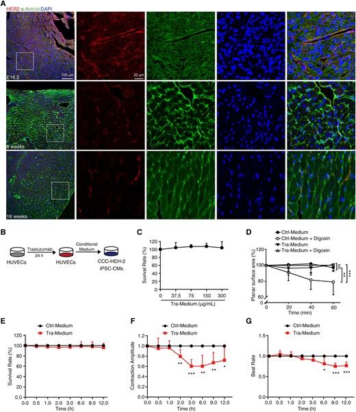 Vascular endothelial cells participate in trastuzumab-induced cardiotoxicity. (A) Representative confocal images of the heart of mouse embryos at Day 16.5 (n = 3 embryos) and of 6-week-old and 16-week-old mice (n = 3 mice) stained with HER2 (red), α-Actinin (green) antibody, and DAPI (blue). Scale bar, 100 μm and 20 μm. (B–G) Effects of conditioned medium on CCC-HEH-2 cells and iPSC-CMs. (B) The schematic diagram of the preparation and application of conditioned medium. (C) SRB colorimetric assay showed the effect of conditioned medium on the survival of CCC-HEH-2 cells (n = 3). (D) Digoxin was used to stimulate the contraction of CCC-HEH-2 cells, and the contractility was calculated by planar surface area (n = 8). (E–G) The normalized survival rate, contraction amplitude, and beat rate of iPSC-CMs (n = 6 individuals). The P-value was calculated by one-way ANOVA (Dunnett’s or Sidak multiple comparisons tests). NS, no significance; *P < 0.05, **P < 0.01, ***P < 0.001.DAPI, 4’,6-diamidino-2-phenylindole; iPSC-CMs, induced pluripotent stem cell-derived cardiomyocytes; Ctrl-Medium, control medium; Tra-Medium, trastuzumab medium.