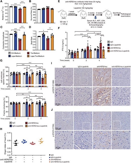 The dual EGFR/HER2 inhibitor lapatinib confers functional protection from trastuzumab-induced cardiotoxicity. (A–D) HUVECs were exposed to trastuzumab with or without lapatinib for 24 h and the conditioned medium was added to CCC-HEH-2 cells and iPSC-CMs. (A) The Ca2+ content of CCC-HEH-2 cells measured by flow cytometry (n = 4). (B–D) The normalized survival rate, contraction amplitude, and beat rate of iPSC-CMs (n = 6 individuals). (E–J) Sprague Dawley rats were treated with saline, anti-HER2/neu antibody, lapatinib, or lapatinib plus anti-HER2/neu antibody for 4 weeks (n = 6 rats). (E) The schematic diagram of animal experiment. (F) Serum was analysed for PTX3 level by ELISA. (G) Cardiac function examined by echocardiography. (H) Organ index of the heart. (I and J) Heart sections were stained with P-EGFR (Y1068) and p-STAT3 (Y705) antibody by immunohistochemistry (n = 3 rats). Scale bar, 100 μm and 25 μm. The P-value was calculated by one-way ANOVA (Sidak test) or two-way ANOVA (Tukey’s test). NS, no significance; *P < 0.05, **P < 0.01, ***P < 0.001. Ctrl-Medium, Control medium; Tra-Medium, trastuzumab medium; Lapa-Medium, lapatinib medium; Lapa/Tra-Medium, lapatinib-plus-trastuzumab medium.
