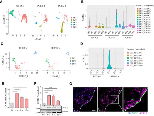 Single-cell transcriptional profiling reveals subpopulational expression of vascular endothelial CCRL2 by proatherosclerosis stimulation. (A) Uniform Manifold Approximation and Projection (UMAP) plot illustrating cell clusters identified in the full single-cell dataset from the left carotid artery of wild-type mice 1 or 2 days after partial carotid ligation (PCL) surgery or without PCL (non-PCL). (B) Violin plots of CCRL2 expression in five EC clusters. (C) UMAP projection of all endothelial cells identified in the full single-cell dataset from the aortic root of ApoE−/− mice fed a high fat diet (HFD) for 0 or 16 weeks. (D) Violin plots of CCRL2 expression in three EC clusters. (E) Male ApoE−/− mice were fed HFD for 0, 4, 8, or 12 weeks. Aortic CCRL2 mRNA expression was determined by real-time quantitative PCR (RT–qPCR), normalized to GAPDH and displayed as fold-change induction relative to baseline (HFD for 0 week) (n = 5 mice per group). **P < 0.01, ****P < 0.0001 by one-way ANOVA with Dunnett’s test for multiple comparisons. (F) Aortic CCRL2 protein expression detected by Western blotting was normalized to β-actin and displayed as fold-changes relative to baseline (n = 3 mice per group). Full blots can be found in the Supplementary material online, Figure S8A. **P < 0.01, ***P < 0.001 by one-way ANOVA with Dunnett’s test for multiple comparisons. (G) Aortic sections from ApoE−/− mice fed HFD for 4 weeks were stained for CCRL2 and CD31. Bar = 20 μm.