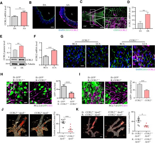 Disturbed blood flow up-regulates vascular CCRL2 expression that promotes leucocyte adhesion and plaque formation. (A) CCRL2 mRNA in the aortic arch (AA) and descending aorta (DA) of C57BL/6J mice was assessed by RT–qPCR (n = 5 per group). **P < 0.01 by unpaired Student’s t-test. (B) CCRL2 protein levels in the aortic arch and descending aorta of WT mice were measured by IF staining with anti-CCRL2 and anti-CD31 antibodies. Bar = 20 μm. (C) CCRL2 protein expression in the GC and LC of the aortic arch in WT mice was detected by en face staining. (red, CCRL2; green, CD31; blue, DAPI). Bar = 100 μm. (D and E) HUVECs were treated for 24 h by OS or LS with a cone-and-plate shear stress device. The expression of CCRL2 was examined by RT–qPCR (D) and Western blotting (E) (n = 3 per group). Full blots can be found in the Supplementary material online, Figure S8B. **P < 0.01 by unpaired Student’s t-test. (F) To induce d-flow, the left carotid artery (LCA) of WT or CCRL2−/− mice was partially ligated. Total carotid RNA before and 24 h after ligation was isolated and analysed for CCRL2 mRNA expression by RT–qPCR, normalized to GAPDH, and expressed as the ratio of ligated LCA to non-ligated (RCA) control (n = 5 per group). ***P < 0.001 by unpaired Student’s t-test. (G) Immunofluorescence staining was performed by en face staining of the carotid intima (red, CCRL2; green, CD31; blue, DAPI). Bar = 20 μm. (H and I) Chimeric mice were generated by transplanting CCRL2+/+ GFP+ bone marrow into irradiated CCRL2+/+ and CCRL2−/− recipients. After 6–8 weeks to allow engraftment and haematopoietic reconstitution, d-flow was induced in the mouse LCA by PCL. After 2 days or 7 days, leucocyte adhesion to the vascular endothelium of the LCA was assessed by en face staining. Green, GFP; red, CD31; Bar = 20 μm. The number of adherent GFP+ leucocytes (H) or the area of adherent GFP+ leucocytes (I) on the vessel wall was quantified in 10–17 fields from 3–4 mice. ***P < 0.001, ****P < 0.0001 by unpaired Student’s t-test. (J) CCRL2+/+ApoE−/− and CCRL2−/−ApoE−/− mice were subjected to PCL. After 2 weeks on HFD, lipid deposition (in red) on mouse LCA was analysed by en face Sudan IV staining. Bar = 1 mm. The lesion surface area was quantified and displayed as the percentage area of the LCA. **P < 0.01 by unpaired Student’s t-test. n = 7 mice per group. (K) Male CCRL2−/−ApoE−/− or CCRL2+/+ApoE−/− mice were lethally irradiated and transplanted with CCRL2+/+ApoE−/− mouse bone marrow cells. Plaque formation in chimeric mice induced by PCL and HFD. *P < 0.05 by unpaired Student’s t-test. n = 6–7 mice per group.