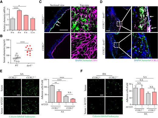 Chemerin recruited by CCRL2 mediates leucocyte adhesion. (A) ApoE−/− mice fed HFD for 0, 4, 8, or 12 weeks were euthanized. mRNA levels in the aorta were measured by RT–qPCR (n = 12). *P < 0.05, ****P < 0.0001 by unpaired Student’s t-test. (B) Serum from ApoE−/− mice fed HFD for 4 weeks was collected from the blood, and serum chemerin levels were measured by an ELISA kit (n = 10–11 mice per group). ****P < 0.0001 by unpaired Student’s t-test. (C) Representative immunofluorescence photomicrographs of aortic sections. En face preparations from CCRL2+/+ and CCRL2−/− mice 7 days after PCL were stained with antibodies against CD31, chemerin and DAPI. Bar = 50 μm. (D) Aortic root sections from CCRL2+/+ApoE−/− and CCRL2−/−ApoE−/− mice fed HFD for 4 weeks were stained for CCRL2 (red) and chemerin (green). Bar = 50 μm. (E and F) Calcein-labelled PBMCs from WT mice were incubated with mouse serum with or without 10 μg/mL anti-chemerin blocking antibody (AF2325) and then added to the luminal side of the aortic arch (E) or descending aorta (F) from CCRL2+/+ or CCRL2−/− mice. The number of adhered leucocytes on the vessel wall was quantified in 8–13 fields from 3 to 4 mice. Bar = 50 μm. **P < 0.01, ****P < 0.0001, N.S, not significant, by one-way ANOVA. EC, endothelial cells; Leu, leucocytes.