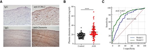 Serum levels of chemerin are elevated in patients with acute atherothrombotic stroke. (A) The expression of CCRL2 and chemerin in human carotid arteries was detected by immunohistochemistry. IgG was the isotype control. (B) Plasma samples were obtained from patients with acute ischemic atherothrombotic stroke (AAS) (n = 111) or age- and gender-matched healthy donors (control, n = 111). Plasma chemerin levels were measured by ELISA. The scatter plot shows individual chemerin concentrations, and horizontal lines represent the median and interquartile ranges. ****P < 0.0001 vs. control by Mann–Whitney U test. (C) Improved diagnostic power by adding chemerin to the conventional risk assessment model for AAS. Receiver operating characteristic (ROC) curves were constructed for a reference model with known AAS risk factors (Model 1) and an improved model combining known AAS risk factors and chemerin (Model 2). The area under the ROC curve (AUC) was calculated for each model. *P < 0.05 vs. Model 1.