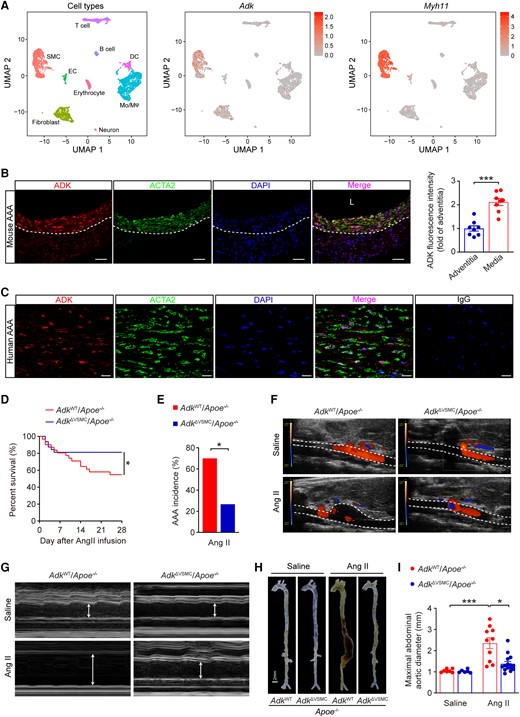 ADK deficiency in VSMCs reduces Ang II-induced AAA formation in Apoe−/− mice. (A) Uniform Manifold Approximation and Projection visualization of cell types present in mouse infrarenal abdominal aortas treated with elastase for 0, 7, and 14 days (left) and the expression of ADK (middle) and Myh11 (right) revealed by scRNA-seq (GSE152583). (B) Representative images (left) of triple immunofluorescence for ADK, ACTA2, and nuclei (DAPI, 4',6-diamidino-2-phenylindole), and quantification (right) of ADK expression in the media and the adventitia of abdominal aortas from male Apoe−/− mice after 4 weeks of Ang II infusion (n = 8), L: lumen, scale bar = 50 μm. (C) Representative images of triple immunofluorescence for ADK, ACTA2, and nuclei (DAPI) on sections of human AAA, scale bar = 20 μm. (D) The survival curve of Ang II-induced AAA in ADKWT/Apoe−/− and ADKΔVSMC/Apoe−/− mice (n = 31–32). (E) The incidence of Ang II-induced AAA in male ADKWT/Apoe−/− and ADKΔVSMC/Apoe−/− mice (n = 10–15). (F, G) Representative colour Doppler ultrasound images of aortic flow (F) and M-mode pictures of abdominal aortas (G) from male ADKWT/Apoe−/− and ADKΔVSMC/Apoe−/− mice following 4 weeks of saline or Ang II infusion. (H) Representative images of whole aortas from male ADKWT/Apoe−/− and ADKΔVSMC/Apoe−/− mice following 4 weeks of saline or Ang II infusion. (I) Maximal abdominal aortic diameter in male ADKWT/Apoe−/− and ADKΔVSMC/Apoe−/− mice following 4 weeks of saline or Ang II infusion (n = 6–15). Two-tailed unpaired Student’s t-test for (B), Mantel–Cox test for (D), two-sided Fisher’s exact test for (E), and Kruskal–Wallis test followed by Dunn’s post hoc test for (I). All data are represented as mean ±SEM *P < 0.05 and ***P < 0.001 for indicated comparisons.