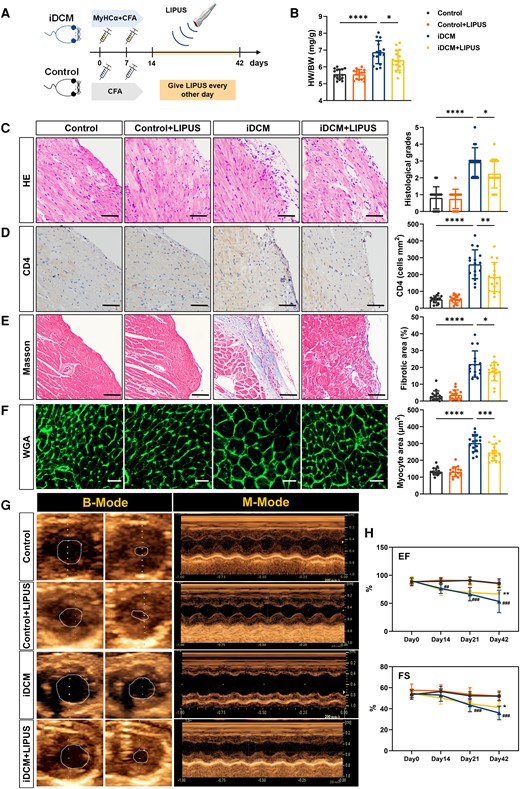 Measurement of cardiac pathological and cardiac function after LIPUS therapy. (A) Mice were injected with MyHCα+CFA or CFA on day 0 and day 7. Mice were given LIPUS treatment every other day from day 7 to day 42 and were sacrificed on day 42. (B) HW/BW ratios were measured on day 42 (P < 0.0001 iDCM vs. Control and P = 0.0242 iDCM + LIPUS vs. iDCM). (C) Cardiac tissue H&E staining was performed (scale bars = 100 μm) and the H&E images were analysed based on histological grades (P < 0.0001 iDCM vs. Control and P = 0.0309 iDCM + LIPUS vs. iDCM). (D) CD4+ cell infiltration in the cardiac sections was analysed by immunohistochemistry (scale bars = 100 μm; P < 0.0001 iDCM vs. Control and P = 0.0033 iDCM + LIPUS vs. iDCM). (E) Representative masson trichrome stains and quantitation of fibrosis in mice hearts. The blue-stained collagen fibre area was expressed as a percentage of the total field area analysed (scale bars = 100 μm; P < 0.0001 iDCM vs. Control and P = 0.0361 iDCM + LIPUS vs. iDCM). (F) FITC-WGA staining of cardiomyocyte membrane (scale bars = 50 μm; P < 0.0001 iDCM vs. Control and P = 0.0006 iDCM + LIPUS vs. iDCM). (G) Typical representative diagrams of four groups on day 42. (H) EF (Day 14: P = 0.0018; Day 21: P = 0.0003; Day42: P = 0.0002# iDCM vs. Control; P = 0.0012 * iDCM + LIPUS vs. iDCM), and FS (Day 21: P = 0.0009; Day42: P = 0.0004 # iDCM vs. Control; P = 0.0391 * iDCM + LIPUS vs. iDCM; B-H, n = 16) was measured using echocardiography. Results are expressed as mean ± SD; one-way ANOVA with Bonferroni post hoc test; *P < 0.05; **P < 0.01; ***P < 0.001; ****P < 0.0001; ##P < 0.01; ###P < 0.001.