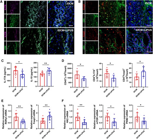 CD4+ T-cell immunometabolic status in the hearts of mice after LIPUS therapy on day 42. (A, B) Immunofluorescence staining was used in iDCM + LIPUS and iDCM mice hearts to show the number of Th17 (CD4+ IL-17A+) cells and Treg (CD4+ Foxp3+) cells (scale bars = 100 μm). (C) Levels of IL-17A and IL-10 in plasma by ELISA (IL-17A: P = 0.0280; IL-10: P = 0.0089, n = 9). (D) The numbers of leucocyte, Th17 cell, and Treg cell were assessed by flow cytometry in mice hearts (CD45+: P = 0.0351; CD4+ IL-17A+: P = 0.0381; CD4+ Foxp3+: P = 0.0471, n = 6). (E) Levels of RORγt mRNA and Foxp3 mRNA expression in the myocardial tissue of mice on day 42 by qPCR (RORγt: P = 0.0034; Foxp3: P = 0.0073, n = 9). (F) Levels of HK2 mRNA, mTOR mRNA and PKM2 mRNA expression in mice myocardial tissues by qPCR (HK2: P = 0.0023, mTOR: P = 0.0105; PKM2: P = 0.0296, n = 9). Results are expressed as mean ± SD. Comparisons of parameters were performed with student's t-test. *P < 0.05; **P < 0.01.