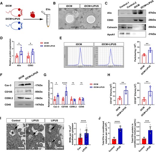 Release of EVs after LIPUS treatment in vitro and in vivo. (A) EVs were isolated from the myocardial tissue of iDCM + LIPUS and iDCM mice on day 42. (B) Representative TEM of isolated EVs from the myocardial tissue (scale bars = 100 nm). (C, D) Representative blots of EVs marker protein (Alix, CD63) and contaminant protein (Calnexin, ApoA1) in EVs purified. CD4+ T-cell lysates were used as a control for Alix, CD63 and Calnexin (Alix: P = 0.0229;CD63: P = 0.0427, N = 5 independent repeats). (E) Representative results of NTA demonstrating size distributions and numbers of EVs (P = 0.0012, n = 5). (F, G) The relative protein expression of cellular markers in EVs were measured by Western Blot (Cav-3: P = 0.0214; CD105: P < 0.0001, N = 5 independent repeats). (H) Cellular origin analysis of EVs isolated from myocardial tissue of iDCM + LIPUS and iDCM mice (CD144+: P = 0.0012; CD105+: P = 0.0047, n = 5). (I) Morphology of HCAECs-derived MVBs observed by TEM (scale bars = 500 nm). Quantification the number of MVBs (P < 0.0001, n = 5). (J) Measured total EVs in conditioned medium per cell by NTA (P < 0.0001, n = 5). Measured total EV proteins in the conditioned medium by bicinchoninic acid assay (BCA) (P = 0.0009, n = 5). Results are expressed as mean ± SD. Comparisons of parameters were performed with student's t-test. *P < 0.05; **P < 0.01; ***P < 0.001; ****P < 0.0001.