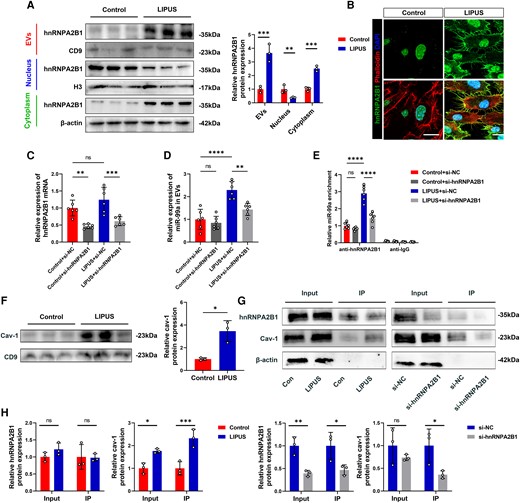 Caveolin-1 interacts with hnRNPA2B1 and traffics together into EVs in response to LIPUS. (A) EVs, nuclear, and cytoplasmic proteins were extracted after LIPUS treatment and subjected to Western Blot analysis (EVs: P = 0.0027; Nuclear: P = 0.0228; Cytoplasm: P = 0.0004, N = 3 independent repeats). (B) hnRNPA2B1 and phalloidin immunofluorescence staining observed under confocal microscope (scale bars = 10 μm). (C) Detection the effect of transfection of si-hnRNPA2B1 in MAECs (P = 0.0030 vs. Control + si-NC; P = 0.0006 vs. LIPUS + si-NC). (D) Detection of miR-99a expression in EVs after transfection with si-hnRNPA2B1 (P < 0.0001 LIPUS + si-NC vs. Control + si-NC; P = 0.0021 vs. LIPUS + si-NC). (E) Detection of miR-99a enrichment after the use of anti-hnRNPA2B1(P < 0.0001 LIPUS + si-NC vs. Control + si-NC; P < 0.0001 vs. LIPUS + NC). (F) Proteins were extracted after LIPUS treatment and subjected to Western Blot analysis (P = 0.0418). (G, H) The samples were immunoprecipitated (IP) with an anti-hnRNPA2B1 antibody (cav-1: Input: P = 0.0063; IP: P = 0.0095 vs. Control; IP: P = 0.0437 vs. si-NC; hnRNPA2B1: Input: P = 0.0072; IP: P = 0.0437 vs. si-NC) (F and H, N = 3 independent repeats; C-E, n = 6). Results are expressed as the mean ± SD; student's t-test (A, F, H) or one-way ANOVA with Bonferroni post hoc test (C, D, E).*P < 0.05; **P < 0.01; ***P < 0.001; ****P < 0.0001.