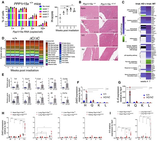 Heart failure is associated with local inflammation and activation of the integrated stress response. (A) Ppp1r15a transcript levels assessed by Single Molecule In Situ Hybridisation (SM-ISH) in heart tissue sections derived from non-irradiated, or irradiated female WT mice, at 13,5 and 7 weeks post-irradiation. H-score of Ppp1r15a expression was analysed by ANOVA and Dunnett’s post-test. (B) Analysis of tissue from Ppp1r15a+/+ (+/+) or Ppp1r15aΔC/ΔC(ΔC/ΔC) male mice (n = 3 mice/group), 7 weeks post-irradiation with H&E staining (scale bar 200 μm). (C) Heatmap of top DEGs related to the selected gene ontology pathways. Comparison between week 4,7 post-irradiation Ppp1r15aΔC/ΔC (KO) and Ppp1r15a+/+ (WT) log2FoldChanges. The Black cell colour represents genes not identified in the corresponding DEGs analysis. (D) Breakdown of immune system cell types found in none and post-irradiation of Ppp1r15a+/+ (+/+) or Ppp1r15aΔC/ΔC(ΔC/ΔC) obtained through RNA-seq sample deconvolution. The number following each group name indicates the days post-irradiation (E) RT-qPCR for inflammatory and ISR gene expression in heart (+/+n = 6, ΔC/ΔC n = 5), P values were determined by two-tailed Student’s t-test. Heart (H), quadricep (Q), kidney (K), and liver (L) tissue taken from male mice at 7 weeks from post-irradiation and analysed for expression for (F) Ddit3 and (G) Il6 (n = 3). Tissue taken from female mice at indicated time post-irradiation analysed for (H) Ddit3 (Heart, Lung, Liver. Kidney) and (I) Il6 gene expression (heart and lung). 7–9 week samples taken at the humane endpoint. Data analysed by two-way ANOVA and Tukey’s post-comparison All data expressed as mean +/-SD. *P < 0.05 **P < 0.01, ***P < 0.001, ****P < 0.0001.