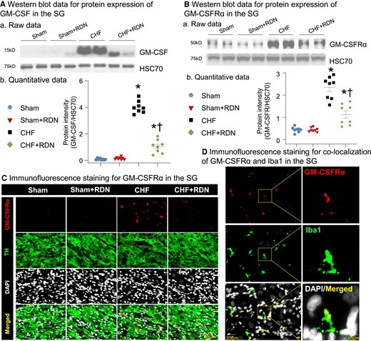 Effect of RDN on CHF-elevated GM-CSF levels and its receptor expression in SGs. (A) Representative images (a) and quantitative data (b) showing the expression of GM-CSF in SGs from all groups, measured by western blot. (B) Raw images (a) and quantitative data (b) of western blot analysis showing the expression of GM-CSF receptor-α subunit (GM-CSFRα) in SGs from all groups. (C) Raw images of immunofluorescence staining showing expression of GM-CSFRα in SGs from all groups. (D) Representative images of immunofluorescence staining showing co-localization of GM-CSFRα and Iba1 (a protein marker for activated macrophages) in SG from the CHF group. n = 8 rats per group. Statistical significance was determined by one-way ANOVA with post hoc Bonferroni test. Data are means ± SEM. *P < 0.05 vs. sham; †P < 0.05 vs. CHF.