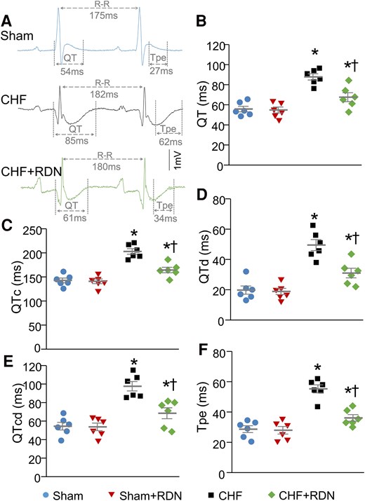 RDN improved CHF-increased heterogeneity of ventricular electrical activities in conscious rats. (A) Representative tracings for QT and Tpe intervals in sham, CHF, and CHF + RDN rats. Quantitative data for QT interval (B), QTc interval (C), QT dispersion (D), QTc dispersion (E), and Tpe interval (F) in all groups. n = 6 rats per group. Statistical significance was determined by one-way ANOVA with post hoc Bonferroni test. Data are means ± SEM. *P < 0.05 vs. sham; †P < 0.05 vs. CHF.