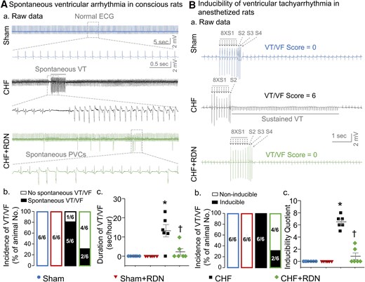RDN ameliorated CHF-increased ventricular arrhythmogenesis in both conscious and anesthetized rats. (A) Raw ECG recordings (a) of VT/VF in conscious sham, CHF, and CHF + RDN rats, and mean data for incidence (b) and cumulative duration of VT/VF (c) in all groups of conscious rats. (B) Raw data (a) for PES-evoked VT/VF in anesthetized sham, CHF, and CHF + RDN rats, and quantitative data for incidence (b) and inducibility quotient (b) of PES-evoked VT/VF in all groups of anesthetized rats. n = 6 rats per group. Statistical significance was determined by Fisher's exact test for the incidence of VT/VF (Ab and Bb) and one-way ANOVA with post hoc Bonferroni test for cumulative duration (Ac) and inducibility quotient (Bc) of VT/VF. Data are means ± SEM. *P < 0.05 vs. sham; †P < 0.05 vs. CHF.