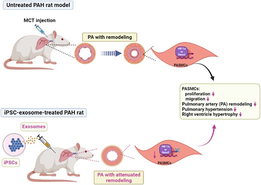 Induced pluripotent stem cell–derived exosomes attenuate vascular ...