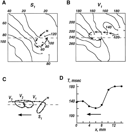 Drift of a spiral wave and the Doppler effect. (A and B) Isochronal activation maps showing initiation (A) and the first rotation cycle (B) of a spiral wave in an isolated preparation of epicardial muscle. A stepwise inhomogeneity in refractory period was created by separate superfusion of two parts of the preparation with normal and quinidine-containing solutions. Dashed line shows the border of inhomogeneity with smaller refractoriness in the upper part. The asterisk shows the location of the stimulation electrode. (C) Trajectory of the spiral wave tip during initiation (S1) and 3 subsequent cycles of spiral wave rotation (V1–V3). (D) Excitation intervals measured along the border of inhomogeneity during spiral wave drift (cycle V2). Because of the drift, excitation intervals in front of the spiral wave are significantly shorter than intervals behind the spiral wave (Doppler effect). Reproduced with permission [74].