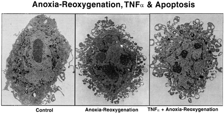 Transmission electron microscopy of cultured HCAECs exposed to hypoxia (24 h), reoxygenation (3 h) and TNFα. Whereas control cells show normal architecture, cells exposed to hypoxia, reoxygenation and TNFα show condensation of chromatin at the periphery and fragmentation of the nucleus, and vacuolization, shrinkage of cytoplasm. In these representative experiments, TNFα was present in the incubation medium throughout the period of hypoxia and reoxygenation. Original magnification — control cell ×8750, hypoxia–reoxygenation ×12 500, TNFα+hypoxia–reoxygenation ×10 000.