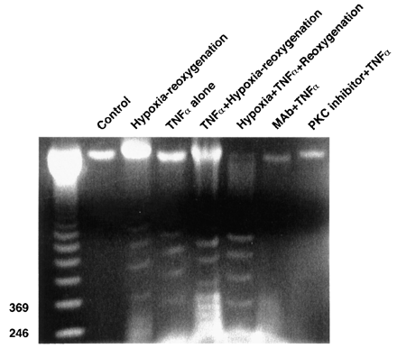 DNA laddering evidence of apoptosis in HCAECs exposed to hypoxia–reoxygenation and TNFα. There is only modest DNA laddering in cells exposed to hypoxia, reoxygenation or TNFα alone. Combination of TNFα and hypoxia–reoxygenation causes additional DNA laddering. MAb to TNFα and the PKC inhibitor both reduce TNFα-mediated DNA laddering.