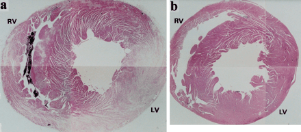 Representative histology of the whole transverse section of the heart. The affected lesion in Group A is widely observed in both ventricles (a; original magnification, ×20), but only focal infiltration by inflammatory is noted in Group B-0 (b; original magnification, ×20).