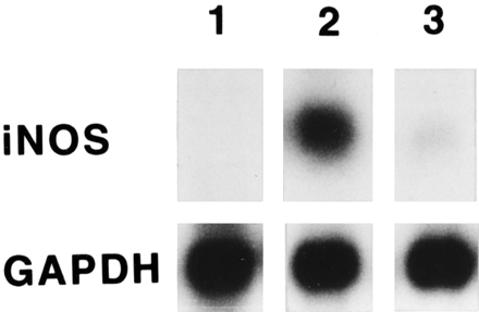 Northern blot analysis for iNOS in heart tissues. Northern blot analysis reveals a distinct band of 1,400 bp that corresponded to the size of murine macrophage iNOS mRNA. The levels of iNOS mRNA are much higher in Group A [2] than in Group B-0 [3], although no iNOS transcript is detected in Group C [1].