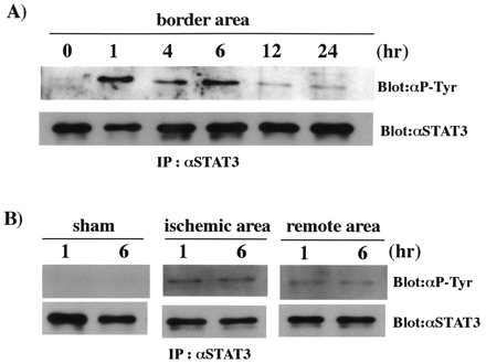 Time course of STAT3 phosphorylation after AMI in rat hearts. Tissue samples obtained from three different areas (ischemic, border and remote areas) were examined at various times after coronary ligation. (A) Equal amount of proteins from border area of rat AMI heart obtained 0, 1, 4, 6, 12 and 24 h after coronary ligation were lysed with RIPA buffer, immunoprecipitated with anti-STAT3 antibody for 4 h at 4°C, separated by 10% SDS–PAGE, and transferred onto an Immobilon-P membrane. The blot was probed with anti-phosphotyrosine antibody (top). The blot was reprobed with anti-STAT3 antibody (bottom). (B) Equal amount of proteins from sham and AMI hearts (ischemic area and remote area) 1 and 6 h after coronary ligation were treated as described above. Representative bands corresponding to the molecular weight of STAT3 (92 kDa) are presented in (A) and (B). Five separate experiments from five different hearts showed the similar results.