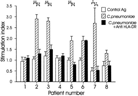 The response (stimulation index±SD) of carotid atherosclerotic plaque derived T cell lines upon incubation with C. pneumoniae and the inhibiting anti-HLA-DR antibody *, P<0.05; **, P<0.005.