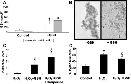 (A) GSH-content of isolated rat neonatal cardiomyocytes (NRCMs) without or with GSH treatment for 60 min (10 mg/ml) and subsequent normoxia (9 h) or hypoxia (8 h) and reoxygenation (1 h). GSH levels of the cell pellets were increased after GSH-exposure. (B) Myocyte cell integrity after 8 h hypoxia and 1 h of reoxygenation (H/R) in untreated NRCMs (left panel) in comparison to GSH-preincubation (right panel). Representative example of three independent cell preparations after Trypan blue staining. (C) NRCMs incubated with GSH (10 mg/ml) with or without cariporide (100 μg/ml) were exposed to H2O2 (0.3 mM) for 12 h and the contractility was scored (cf. Materials and methods). Quantification of four independent cell preparations. (D) Viability of NRCMs (Trypan blue exclusion) after identical H2O2 stimulation without or with GSH exposure. (*=p<0.05 vs. control, §=p<0.05 vs. H2O2).