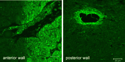 TNFα in myocardium and vasculature. Immunohistological staining of tissue slices from the anterior and the posterior wall. In the anterior wall, distinct areas of myocytes adjacent to an embolizing microsphere are stained positive for TNFα; in the posterior wall staining is confined to the vascular wall (scaling bar 20 μm).