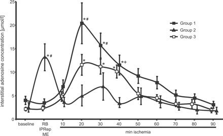 Interstitial adenosine concentration. In group 1, the interstitial adenosine concentration increased after the onset of the sustained ischemia. In group 2, the interstitial adenosine increased six-fold during reperfusion (IPRep) following ischemic preconditioning. In group 3, the interstitial adenosine concentration remained unchanged with coronary microembolization (ME), but increased after the onset of the sustained ischemia. With ischemic preconditioning and coronary microembolization, the maximal increases in the interstitial adenosine concentration during the sustained ischemia were attenuated. (RB: repeated baseline measurement in group 1; IPRep: 10 min of reperfusion following ischemic preconditioning in group 2; ME: 10 min after coronary microembolization in group 3; *p<0.05 vs. Baseline; #p<0.05 Group 1 vs. Group 2 and 3; +p<0.05 Group 1 vs. Group 2).