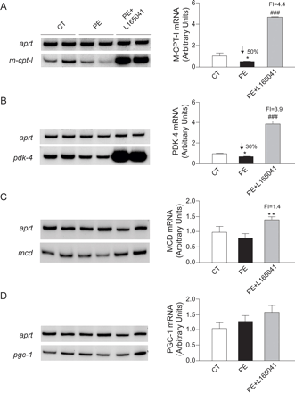 L-165041可防止PE-刺激的新生大鼠心肌细胞中与脂肪酸脂质代谢有关的几个基因的表达下调。在存在或不存在10μmol/L L-165041的情况下，分析PE-刺激心肌细胞中M-CPT-I（A）、PDK-4（B）、MCD（C）和PGC-1（C）的mRNA水平。图中显示了代表性的自动放射自显影图和归一化为APRT mRNA水平的定量。数据表示为五个不同实验的平均值±S.D*与对照组相比，P<0.05和**P<0.01###与PE刺激的心肌细胞相比，P＜0.001。