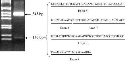 Left panel: Fragments of 343 bp and of 140 bp obtained by amplification of cDNA with the primers flanking exon 6 and electrophoresis. Right panel: Nucleotide sequence of the 140 bp fragment, with the corresponding exons.