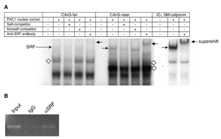 A) Electrophoretic mobility shift assay of smoothelin-A CArG-far and CArG-near boxes and of the intronic SM-calponin CArG box (IC1 SM-calponin). Both smoothelin-A CArG boxes bound several nucleoprotein complexes, including a SRF-containing complex. Supershifted complexes are indicated by a left pointing arrow, SRF bound to CArG boxes is indicated by a right pointing arrow, additional specific complexes binding the smoothelin-A CArG boxes are indicated by diamonds. B) ChIP assay results showing an enriched PCR product from PAC1 SMC nucleoprotein encompassing SRF and the tandem smoothelin-A CArG boxes following immunoprecipitation with antibody to SRF (αSRF). Control IgG shows little to no PCR product. The input lane represents genomic DNA prior to immunoprecipitation.