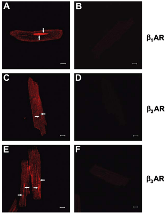 Detection of βAR isoforms in isolated adult rat ventricular cardiomyocytes using immunocytochemistry. Panels A, C and E are representative confocal images showing the distribution of β1AR (A), β2AR (C) or β3AR (E), respectively. Controls were performed in the absence of primary antibody (B, D and F). Scale bar is 10 μm. Arrows indicate nuclei. Data are representative of three independent experiments.