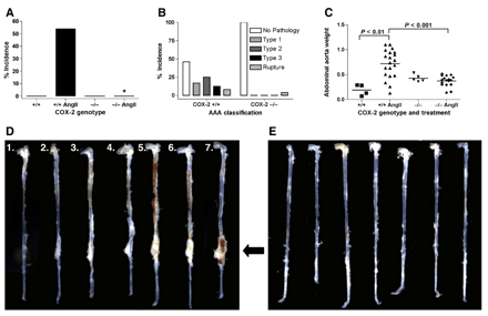 AngII-induced AAA formation in COX-2+/+ and COX-2−/− mice. (A) AAA incidence and (B) AAA severity following 28 days of AngII infusion. n≥20, *, P<0.001, χ2 test. (C) Abdominal aorta weight (normalized to total body weight (μg aorta/g body weight) for saline- (▪) or AngII-treated (▴) COX-2+/+ mice, and saline- (▾) or AngII-treated (♦) COX-2−/− mice. P values determined by Mann Whitney test. Representative aortas from AngII-infused (D) COX-2+/+ mice (1, 2: no pathology; 3, 4: Type 1; 5, 6: Type 2; 7: Type 3) and (E) COX-2−/− mice following 21 days of AngII infusion. Arrow indicates abdominal aorta.