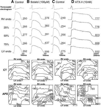 Transseptal electrogram, action potential (AP) recordings, isochronal maps of conduction time (CT), and isochronal maps of action potential duration (APD) in the absence (A and C) and presence of sotalol (100 μmol/l, B) and ATX-II (10 nmol/l, D) at pacing cycle length (CL) of 4000 ms. The action potentials were from five transseptal sites: RV side of the endocardium (RV endo), 25%, 50%, 75% across the IVS from the RV endo, and LV side of the endocardium (LV endo). A and B were from a single tissue. C and D were from another tissue. The longest APDs were always at the LV septal endocardium.