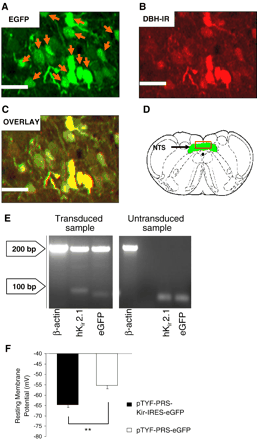 Validation of hKir2.1 expression in vivo and in vitro. Microinjection of LVV-PRS-Kir-IRES-eGFP into the NTS resulted in eGFP-expressing neurons (A) which stained positive for the NEergic marker DBH (B). The overlay (C) shows that the majority of DBH immunoreactivity (IR) co-localised with eGFP IR. Scale bar 40 μm. D shows a schematic transverse section of the caudal medulla (DVM, green) with the red box highlighting the region corresponding to panels A–C. Agarose electrophoresis of RT-PCR products (E) confirmed the expression of hKir2.1 and eGFP only in LVV-PRS-Kir-IRES-eGFP transduced NTS but not in naïve tissue. The membrane potential in PC12 cells transfected with pTYF-PRS-Kir-IRES-eGFP (PRSx8 promoter cloned in antisense direction) was significantly more negative than in pTYF-PRS-eGFP transfected controls (−64.7±−1.2 mV vs. −55.3±−1.6 mV, p<0.01) There was no significant difference in membrane potential in PC12 cells transfected with the sense and antisense pTYF-PRS-Kir-IRES-eGFP (data not shown).