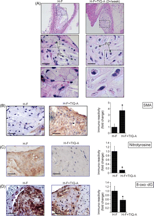 PARP inhibition causes structural changes and reduces markers of oxidative stress within atherosclerotic plaques of high-fat-diet-fed ApoE−/− mice. (A) H&E stain of aortas from ApoE−/− high-fat (H-F) diet or high-fat with thieno[2,3-c]isoquinolin-5-one injections (3 mg/kg) twice a week (H-F+TIQ-A) for 12 weeks; FC, foam cells. Immunohistochemistry analysis of plaques from high-fat and high-fat with thieno[2,3-c]isoquinolin-5-one animal groups with antibodies to SMA (B), nitro-tyrosine (C), or to 8-oxo-dG (D); the rightmost panels are quantifications of immunoreactivity using Image-Pro Plus software and expressed as fold change from plaques of high-fat-diet-fed ApoE−/− mice. *P < 0.01). Bars: 3 µm.