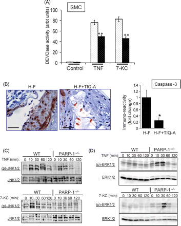 PARP-1 gene deletion reduces caspase-3-like activity, reduces JNK phosphorylation, and induces ERK1/2 phosphorylation in response to TNF or 7-KC in SMCs. (A) Cells were treated with TNF (and CHX) or 7-KC for 6 h after which protein extracts were assayed for caspase-3-like (DEVDase) activity. **P < 0.001. (B) Immunohistochemistry analysis of plaques from H-F and H-F+TIQ-A animal groups with antibodies to the active peptide of caspase-3; the rightmost panel is a quantification of immunoreactivity using Image-Pro Plus software and expressed as fold change from plaques of H-F diet-fed ApoE−/− mice. * difference from H-F diet-fed ApoE−/− mice, P < 0.01. Bars: 3 µm. Cells were treated as in (A) for the indicated time intervals after which protein extracts were subjected to Western immunoblot analysis with antibodies to pJNK1/2 or JNK1/2 (C) or pERK1/2 or ERK1/2 (D).